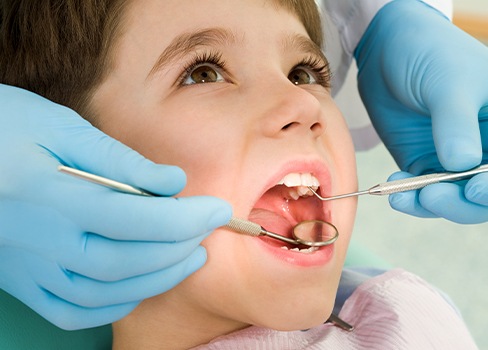 Closeup of child receiving dental checkup