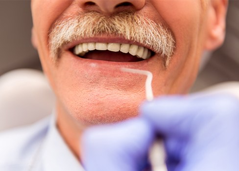 Closeup of man's smile