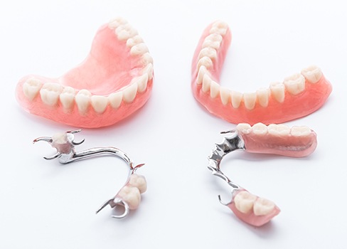 Four types of dentures