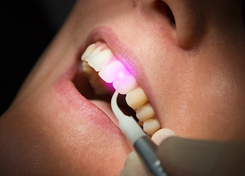 Patient receiving laser dentistry treatment